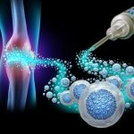 stem cell therapy in kitchener